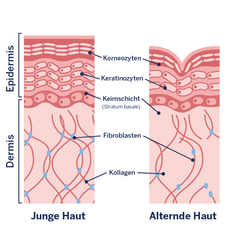 Grafik der Hautalterung bzw. Faltenbildung