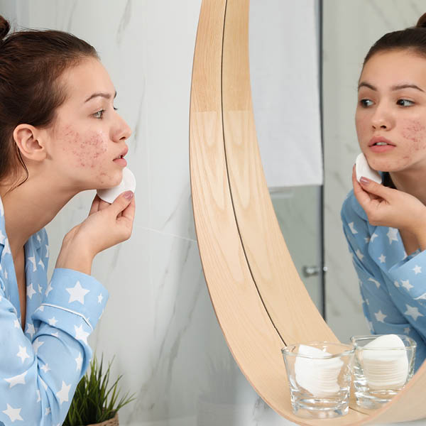 Eine junge Frau betrachtet ihre Akne im Spiegel.