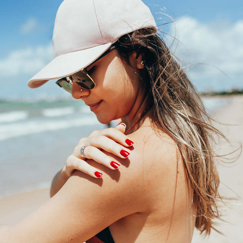 Frau cremt ihre Schulter mit Sonnencreme ein