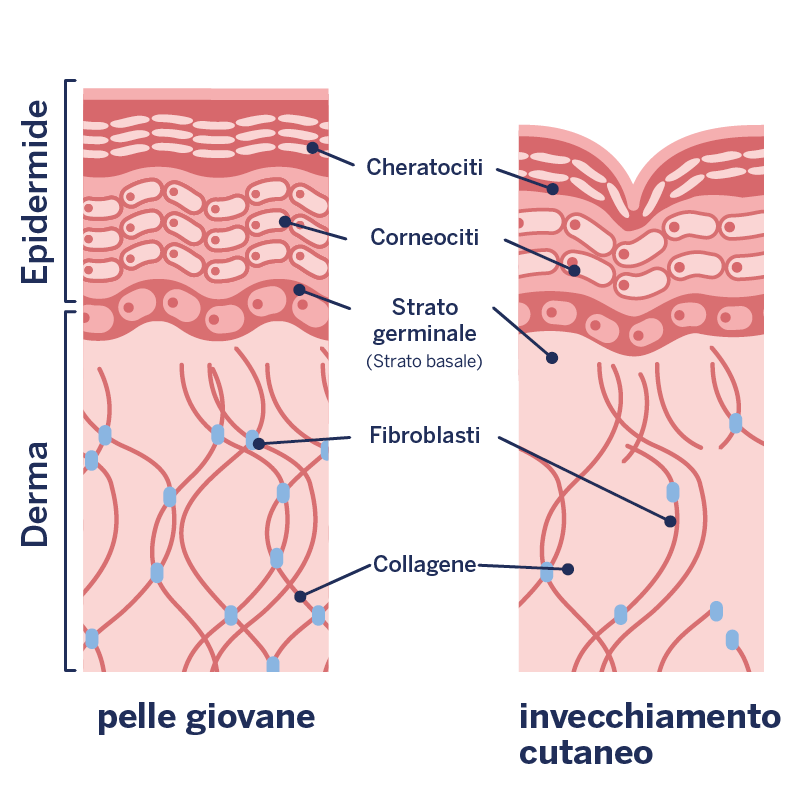 Immagine dell'invecchiamento cutaneo o della formazione di rughe
