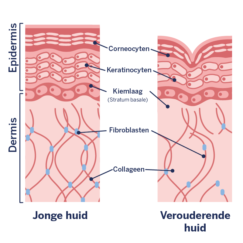 Afbeelding van huidveroudering of rimpels