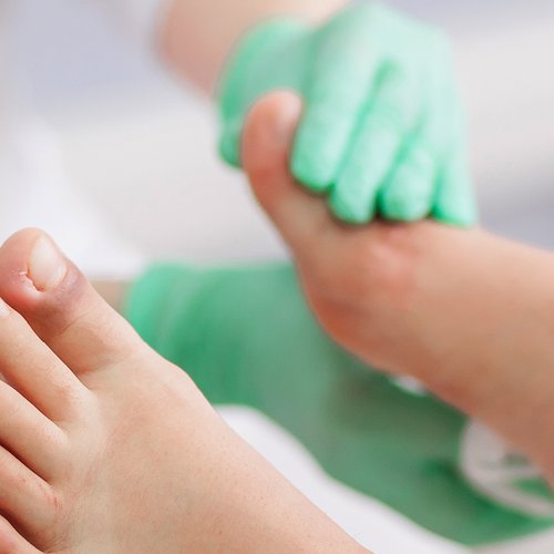 Diabetisches Fußsyndrom – Ursachen und Pflegetipps